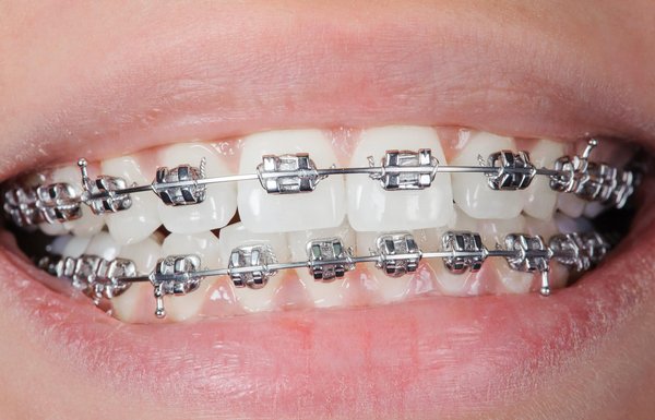 Proposez-vous des soins d'orthodontie à Laval ?